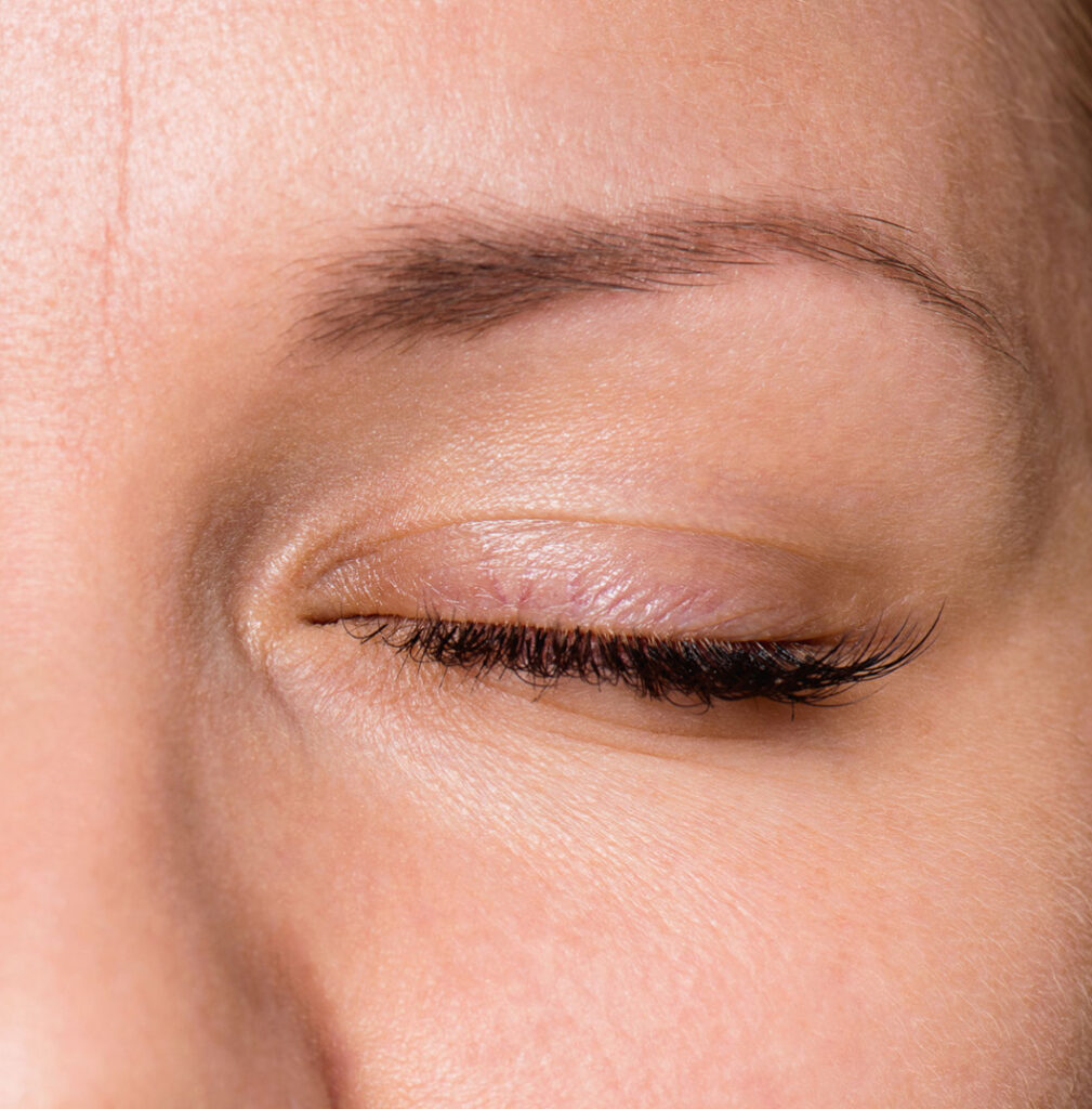 Traitement des paupières