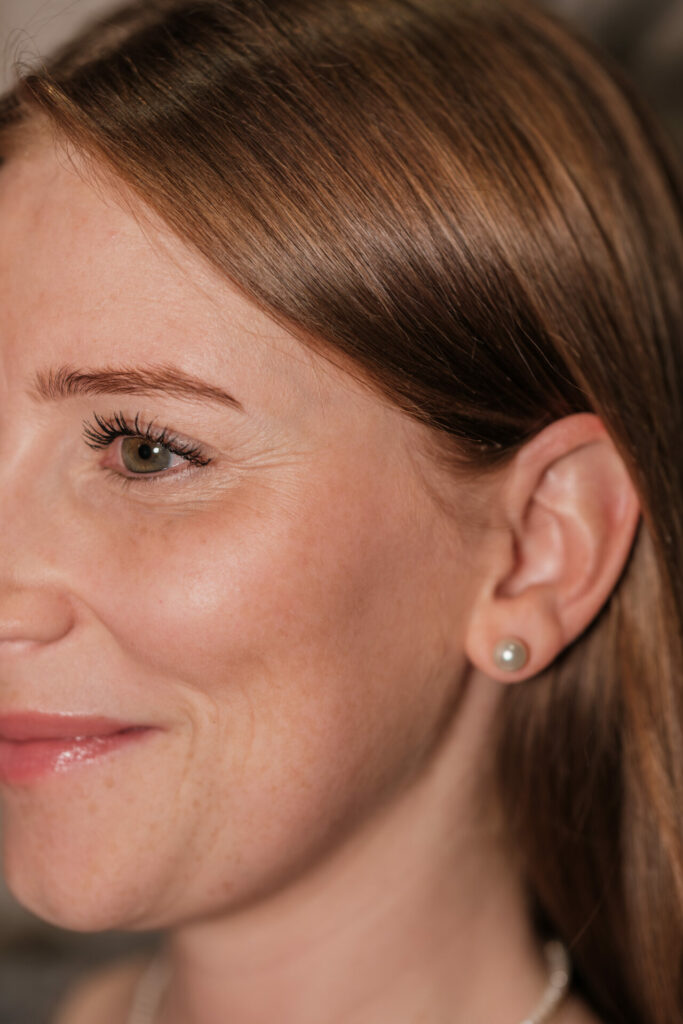 Traitement esthétique du visage lyon