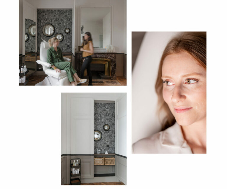 Injections acide hyaluronique pommettes