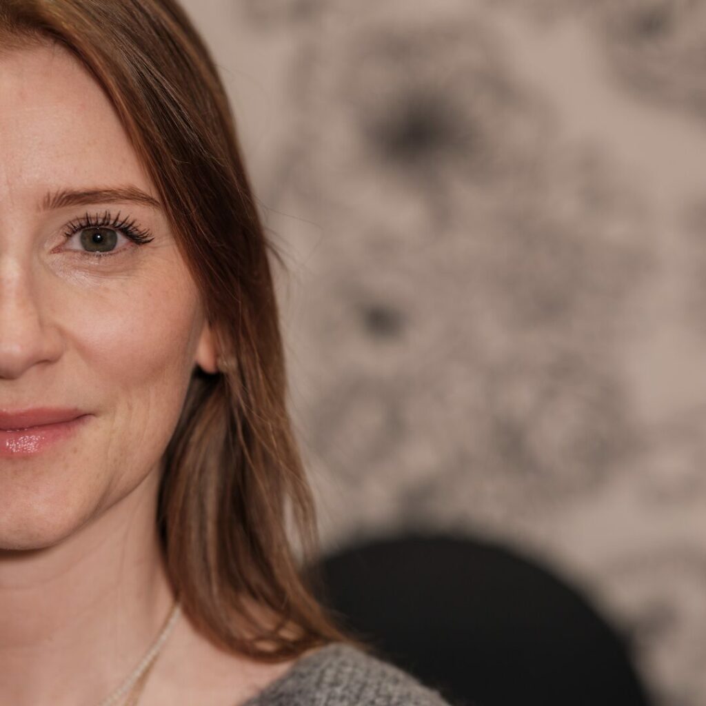 Traitement des cernes à Lyon chez Seize mai