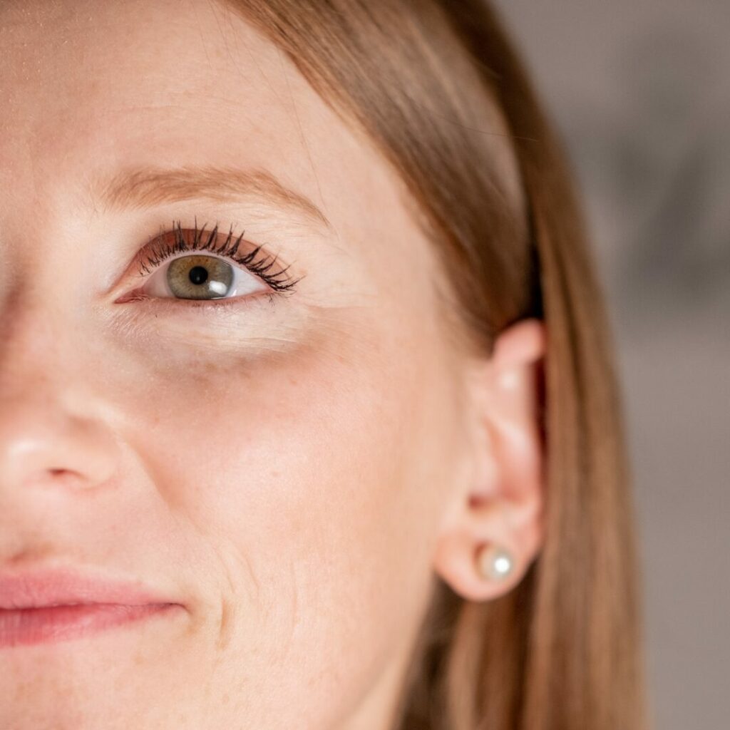 Traiter les cernes par l'acide hyaluronique