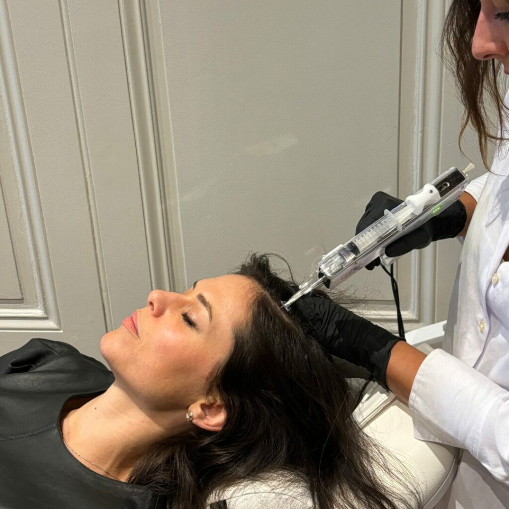 mésothérapie capillaire