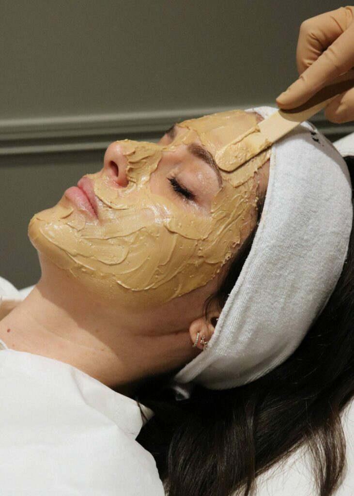 Peeling Dermamelan pour traiter le masque de grossesse (melasma)